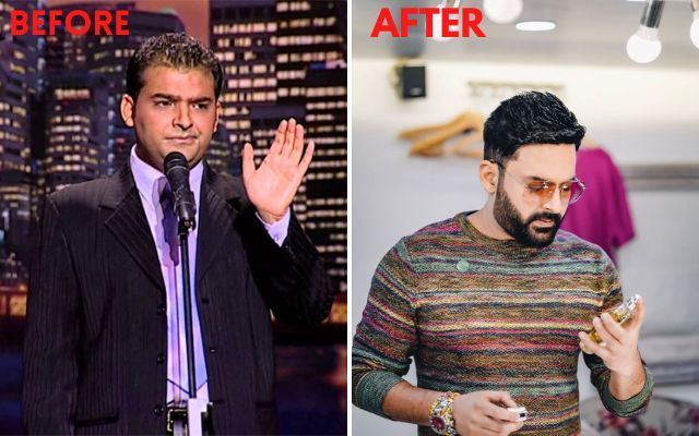 These Punjabi Celebrities Underwent Hair Transplant! These Punjabi Celebrities Underwent Hair Transplant!