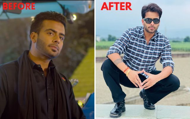 These Punjabi Celebrities Underwent Hair Transplant!